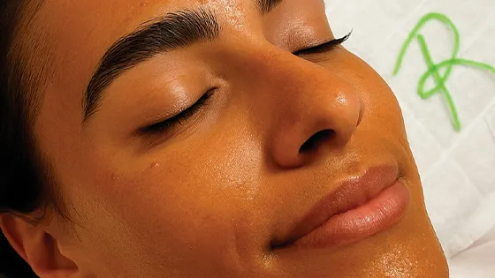 Transforme Sua Pele com o Tratamento Cosmelan